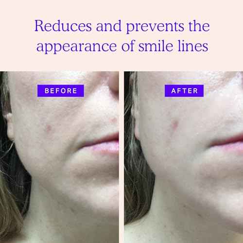 BLUMBODY Smile Line Patches ? Face Wrinkle Patches for Fine Lines Around Mouth, between Eyes ? Non-Silicone Anti-Wrinkle Facial Tape ? Comfortable Overnight Use (90-Day Supply)