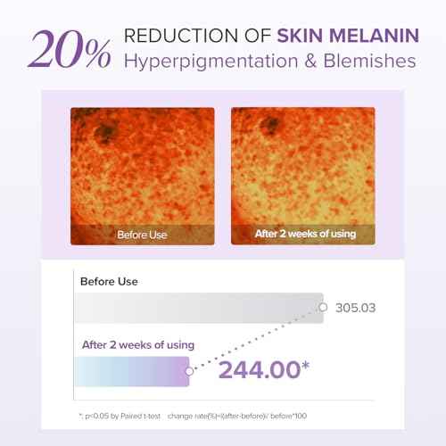 Mary&May Tranexamic Acid (TXA)+Glutathione Eye Cream | Dark Circles & Hyperpigmentation | With Niacinamide & Vitamin C | Firms Under Eye Area | Wrinkle & Fine Line Care | Korean Skincare, 1.01 oz.