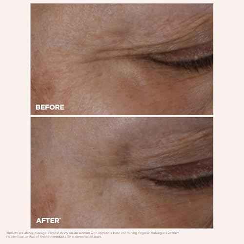 Clarins NEW Total Eye Lift | Anti Aging Eye Cream | Targets Wrinkles, Crow's Feet, Dark Circles and Puffiness For a Visible Eye Lift in 30 Seconds | REFILLABLE