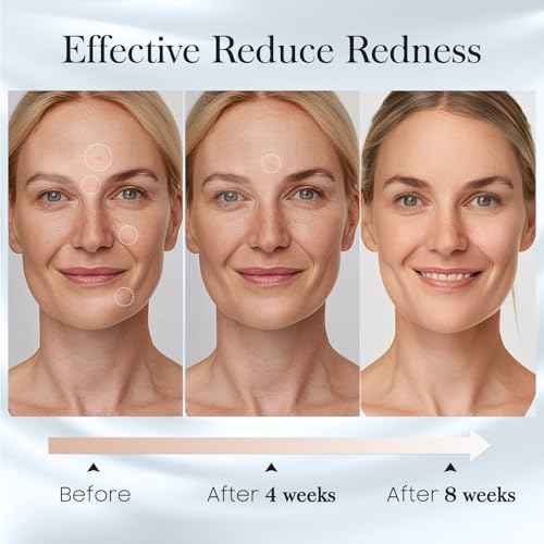 100 Count (2 Box) XL Disposable Face Towels 10¡± x 12¡±, 100% Viscose Fibre, Soft & Skin Friendly Face Towelettes Disposable, Facial Tissue Wipes for Women Cleansing