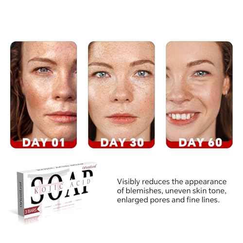 Kojic Acid Soap, Turmeric Soap Bar for Dark Spots, Fresh Citurs Scent, Gentle for Face and Body Wash with Vitamin C, Shea Butter, Retinol, Olive Oil, Collagen (3 PACK)