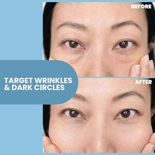 Eva Naturals Eye Gel for Dark Circles, Bags & Puffiness ? Anti-Aging Serum with Peptides, Hyaluronic Acid & Botanicals ? Firming Under Eye Treatment for Wrinkles, Fine Lines & Tired Skin ? 2 oz 2 Pack