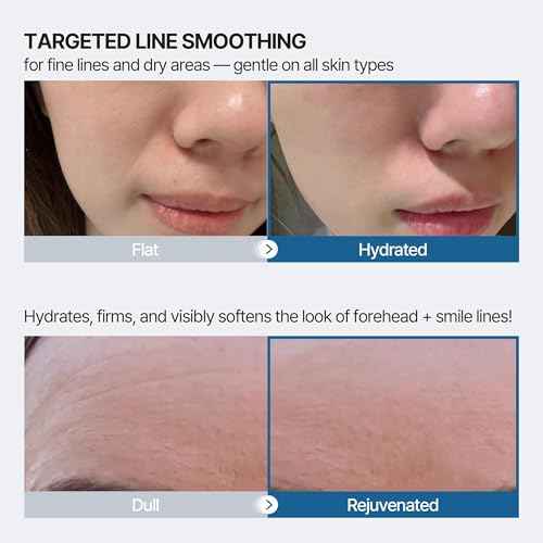 Honeydew Labs Forehead Wrinkle Patches and Smile Line Patches with Retinol, Collagen, Peptides- Anti Wrinkle Patches - Face Tape Overnight Wrinkle Treament for Woman for Smoothing and Firming (36PCS)