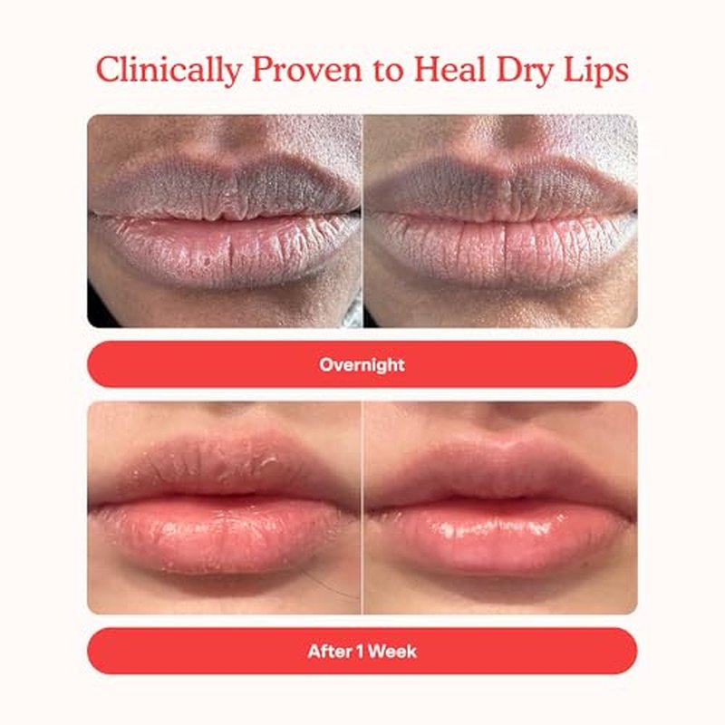 Tower 28 LipSoftie Tinted Lip Balm Treatment - Hydrating Glossy Balm + Overnight Lip Mask with Jojoba Oil + Shea Butter - Sweet, Cushiony Formula for Smooth, Soft Lips - Blood Orange Vanilla (0.38 oz)