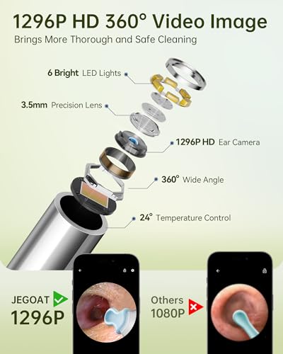 Ear Wax Removal, Ear Cleaner with Camera, Ear Cleaning Kit 1296P HD Ear Scope, 6 LED Lights and 10 Ear Picks, Earwax Removal with Otoscope to Earify Earwax, iOS and Android