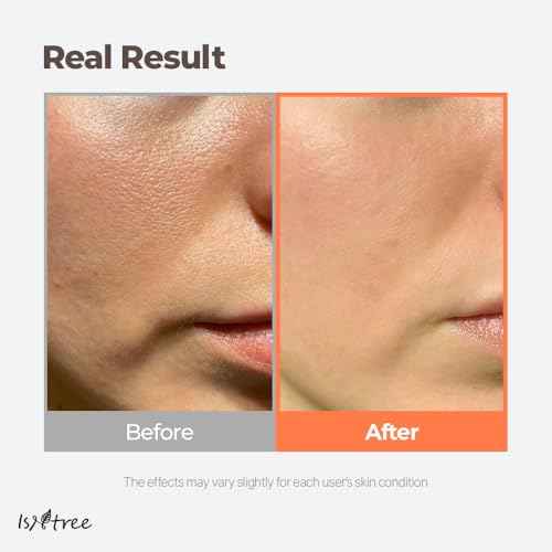 ISNTREE Green Tea Fresh Toner 200ml, 6.76 fl.oz | Korean Skincare | Toner for Oily Skin | Sebum Control | Hydrating and Refreshing