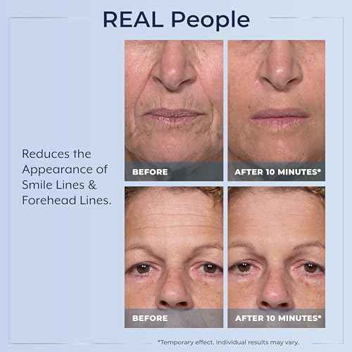 Plexaderm Rapid Reduction Eye Serum - Visibly Reduces Under-Eye Bags, Wrinkles, Dark Circles, Fine Lines & Crow's Feet Instantly, Anti Aging Wrinkle Remover for Face, Full Size Tube