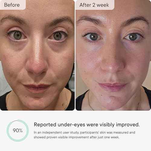 Qure Micro-Infusion Anti Wrinkle Patches for Smile Line, Frown lines, Under Eye Bags, Puffiness, Crow's Feet - Retinol, Caffeine, Peptides - Dissolvable for Overnight Use - 8 Pairs