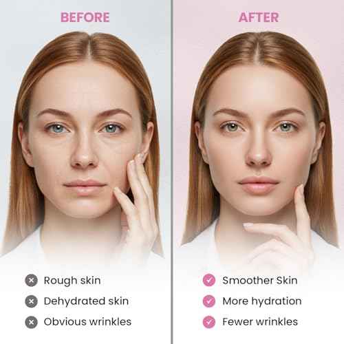 New Anti Facial Wrinkle Patches: Anti Wrinkle Patches Overnight - Smile Line Pathces - Facial Wrinkle Patche for Forehead, Smile Line, Under Eye 144 Pcsx 1Pack