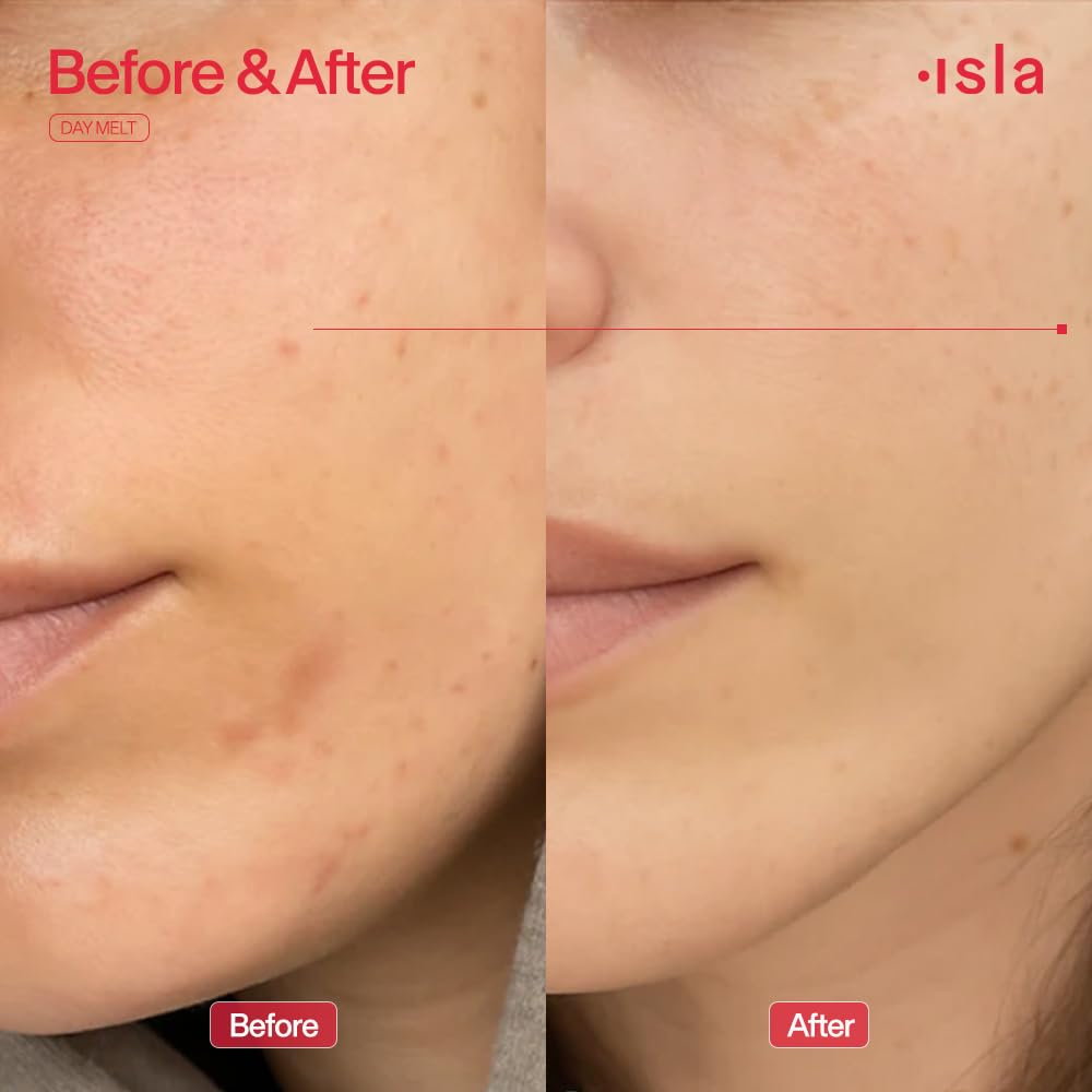 ISLA Day Melt Cleansing Balm - Gentle Makeup Removal & SPF Protection | 2.99 oz, Olive Oil & Vitamin E