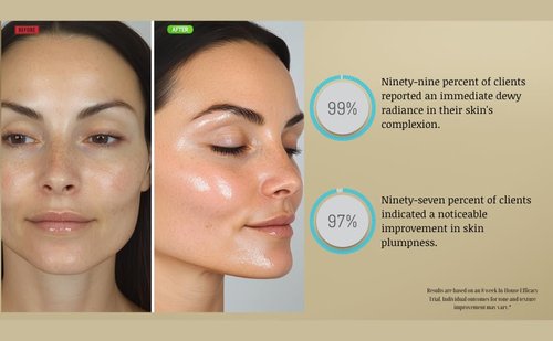 Regine Switzerland Hyaluronic Acid Serum - Hydrating Anti-Aging Formula with Vitamin B5 | Smooths & Plumps Skin