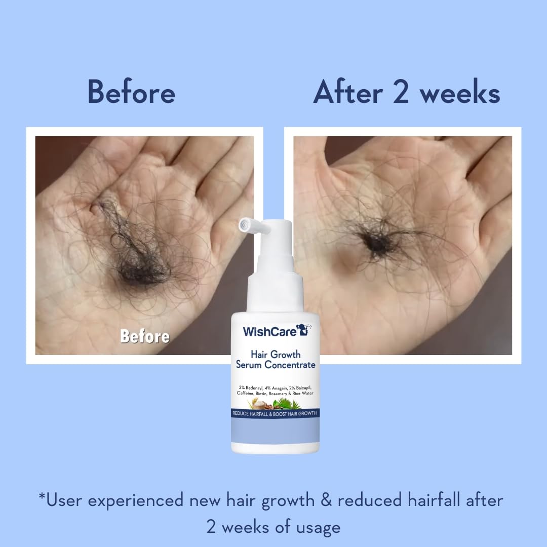 WishCare Hair Growth Serum - Concentrated Formula with Rosemary, Redensyl, Biotin & Caffeine, 1.7 oz