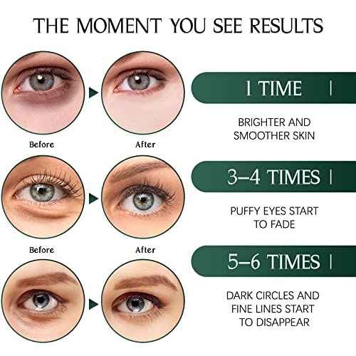 Tiepetly Under Eye Masks with Collagen, Green Tea Eye Patches for Dark Circles and Puffiness, Hydrating, Anti Wrinkle, 60 pcs