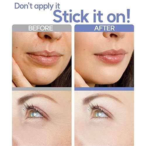 Dissolving Microdart Depuffing Patches for Under Eye and Smile line with Hyaluronic Acid and Tea Tree - 3 pairs - Anti wrinkle patches for face overnight