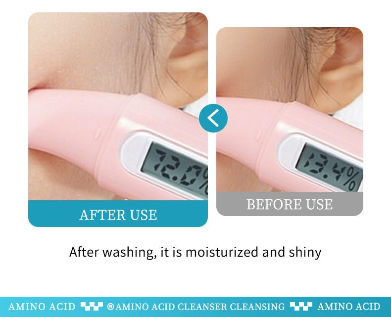 Skiennix Acid Facial Cleansing Mousse - Gentle Hydrating Foaming Face Wash, 2.1 FL.OZ