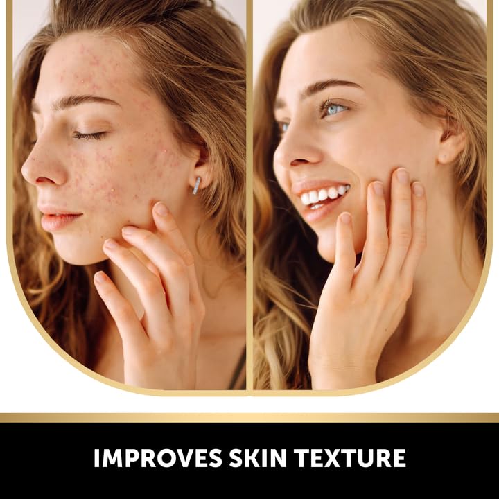 VALITIC Kojic Acid Dark Spot Remover Soap - Turmeric & Vitamin C Infused | 2 Pack with African Net Sponge