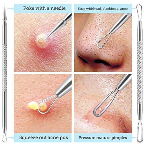 LitBear Pore Prep Tool, Blackhead Remover Pimple Popper Tool Kit, Stainless Steel Blackhead Extractions Tool for Acne, Whitehead Popping, Blemish, Comedone, Black