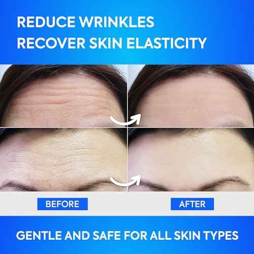 Forehead Wrinkle Patches 12Pcs with Aloe, Collagen, Vitamin E, Anti Wrinkle Patches, Forehead Wrinkles Treatment