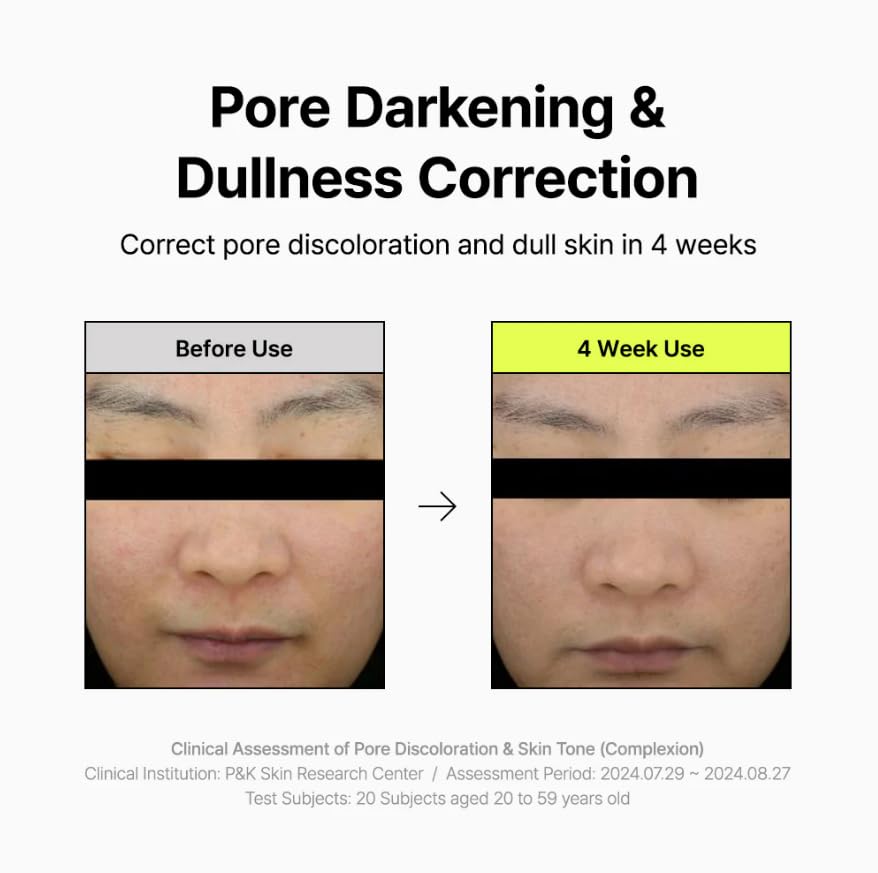 By Wishtrend Pore Smoothing Bakuchiol Serum 1.01 Fl Oz, Powerful Pore Care, Niacinamide, Peptide, Collagen