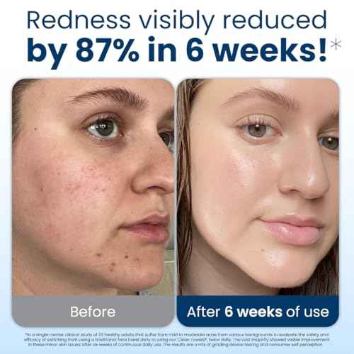 Clean Skin Club Clean Towels XL¢ç, 100% USDA Biobased Face Towel, Disposable Face Towelette, Eczema Association Accepted, Makeup Remover Dry Wipes, Ultra Soft, 1 Pack, 50 Ct