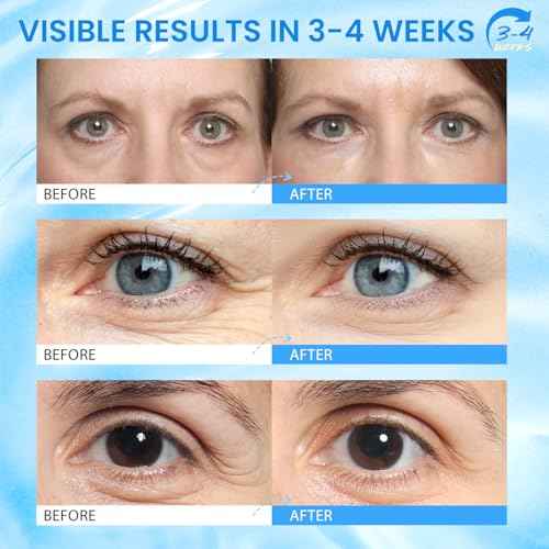 Caffeine Eye Cream for Dark Circles: Caffeine Eye Stick - Smooth Fine Lines and Hydrate Eye Area