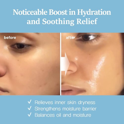 Nightingale Ecto-Hyaluronic Ampoule - 8-Layer Hyaluronic Acid Serum for Dry Skin | Fragrance-Free, Vegan