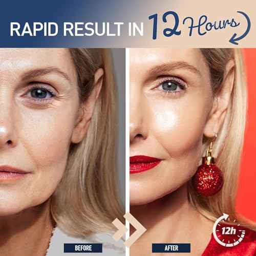 Enaskin Naturals Instant Eye & Face Lift Cream - Rapid Tightener and Wrinkle Filler for Deep Wrinkles - Under-Eye Bags & Puffiness Remover - Temporary Face Firming for Women & Men in 60s - 0.5 oz