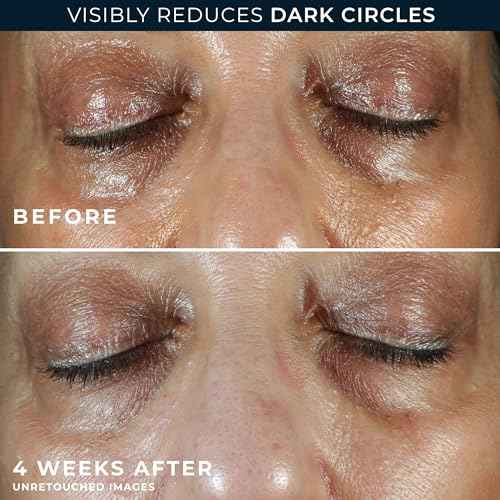 RoC Multi Correxion 5 in 1 Anti-Aging Eye Cream for Puffiness, Under Eye Bags & Dark Circles, Skin Care Treatment with Shea Butter, (.5 oz) with Night Cream Packette (Packaging May Vary)