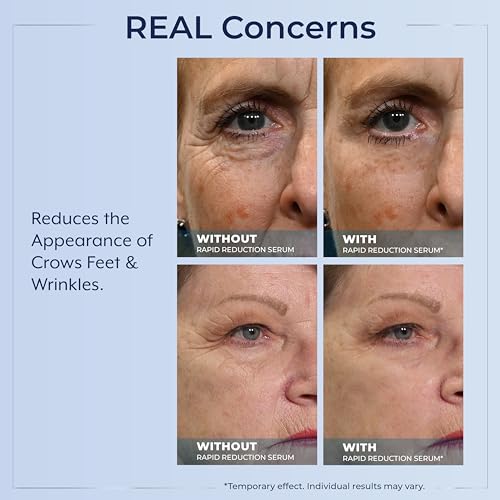 Plexaderm Rapid Reduction Eye Serum - Visibly Reduces Under-Eye Bags, Wrinkles, Dark Circles, Fine Lines & Crow's Feet Instantly, Anti Aging Wrinkle Remover for Face, Pump