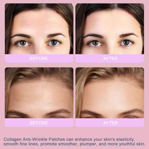 Forehead Wrinkle Patches, Collagen Anti Wrinkle Patches Overnight, Forehead Serum Patch Smooth Fine Lines & Wrinkles, Soft Facial Patches 16 Pcs