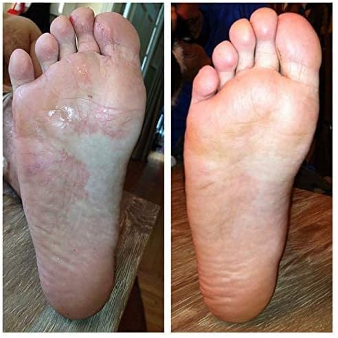 Skiennix Advanced Foot & Shoe Deodorizer Spray - Promotes Healthy Nails & Fungal Treatment | 150ml