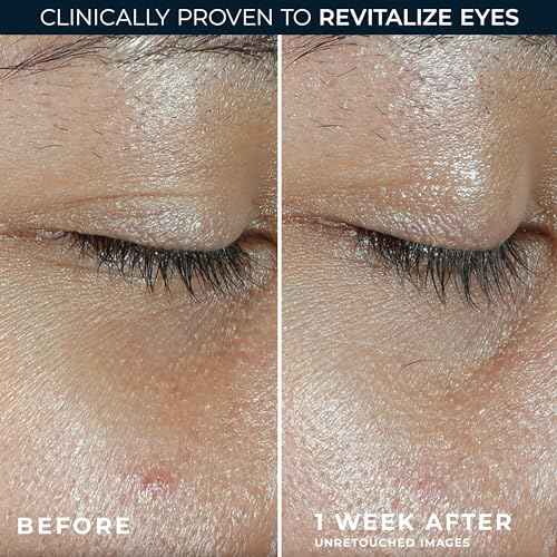 RoC Multi Correxion Revive + Glow Eye Balm with Vitamin C (0.14 oz) + Retinol Eye Cream Packette