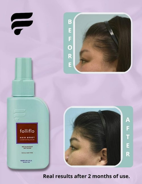 Folliflo Hair Boost Leave-In Conditioner Spray - Thicker-Looking Hair & Scalp Care | Lightweight Daily Formula, 90-Day Supply