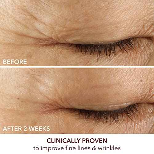 Dr. Dennis Gross Advanced Retinol + Ferulic Eye Serum ? Target Dark Circles, Puffiness, Fine Lines & Wrinkles for Smooth, Youthful-Looking Eyes, 0.5 oz