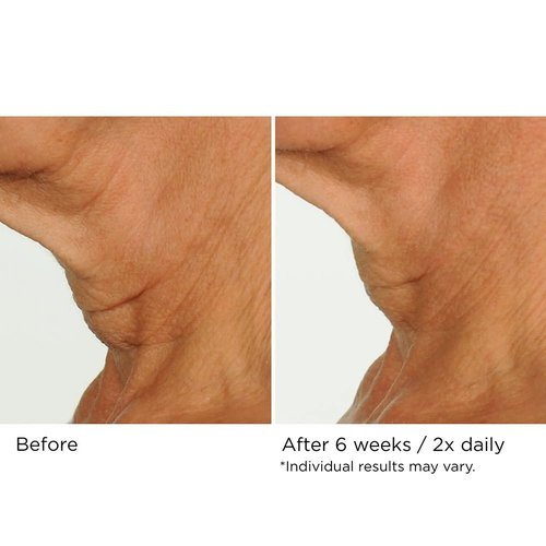 NassifMD Neck & Decollete Firming Complex - Lifting Treatment for Youthful Skin