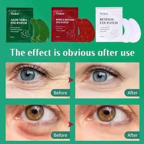 Under Eye Patches For Puffy Eyes and Dark Circles Wrinkle,30 Pairs Face Masks SkinCare With Retinol Serum,Aloe Vera,Rose Betaine