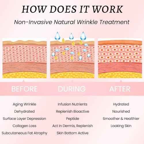 Kaely Wrinkle Patches for Face Overnight, Silicone Scar Tape for Wrinkles Forehead, Smile Line, Face Tape for Wrinkles Overnight Sleeping Lifting Sagging Skin, 192 Pcs (12 Sheets of 16 Patches)