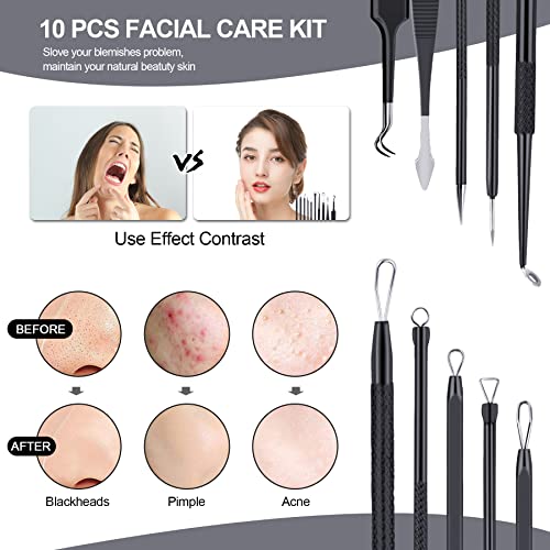 MENOLY Pimple Popper Tool Kit 10 Pcs, Pimple Blackhead Remover Tool Zit Popper for Blemish, Pimple Comedone Extractor Acne Tool for Blackheads, Acnes, Whiteheads Nose Face Tools with Leather Bag