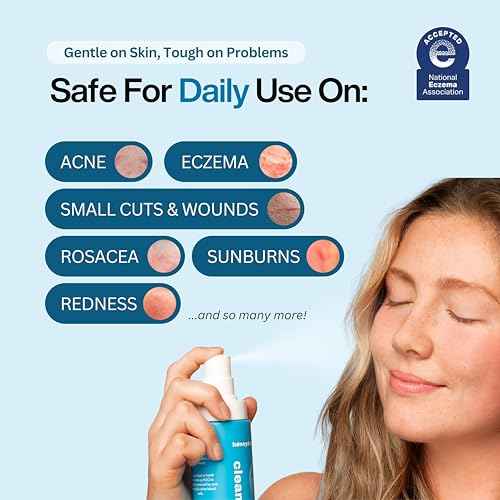 Honeydew Labs Hypochlorous Acid Spray ? HOCl Face & Skin Mist for Acne, Eczema & Irritation ? Multi-Purpose Skin Repair ? Eyelid Cleanser, Post-Workout, Post-Procedure, Scalp & Sensitive Skin ? 6.8 oz