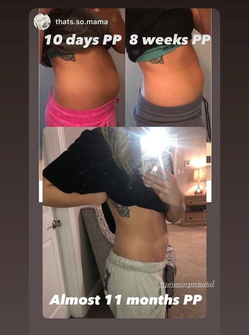 Promise Stretch Mark Prevention Bump Oil - Non-Toxic Vegan Pregnancy Skincare | Fast-Drying Defense & Repair