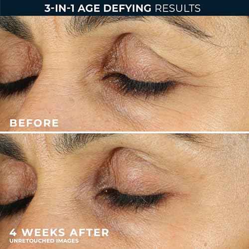 RoC Retinol Correxion Eye Cream Mini for Dark Circles & Puffiness, Daily Wrinkle Cream, Anti Aging Line Smoothing Skin Care Treatment, .25 Ounces