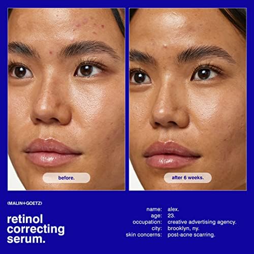 MALIN+GOETZ Retinol Correcting Serum - Multi-Vitamin Formula with A, C, E & Superoxide Dismutase | Smooths Texture & Reduces Fine Lines | 1 Fl Oz