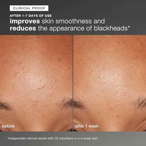 Dermalogica Daily Microfoliant, Face Exfoliator Scrub Powder with Salicylic Acid and Papaya Enzyme, Achieve Brighter, Smoother Skin Daily