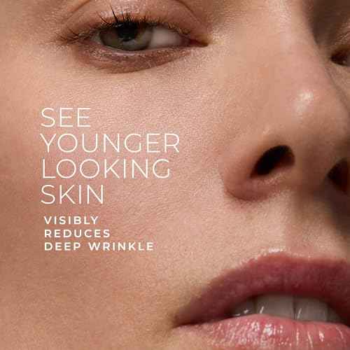 RoC Retinol Correxion Deep Wrinkle Retinol Face Serum with Ascorbic Acid, Anti-Aging Treatment for Fine Lines, Dark Spots, Post Acne Scars, 1 Oz (Packaging May Vary)