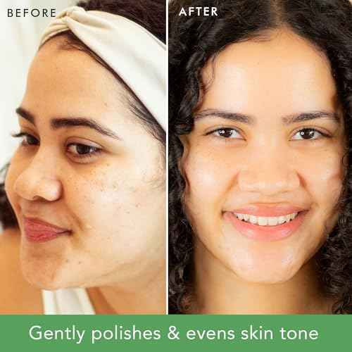 Facial Scrub Exfoliator - USA Made with Natural & Organic Ingredients, Gentle Exfoliating Face Wash for Sensitive & Acne Prone Skin, Microdermabrasion Scrub, Removes Dead Skin Cells (2 Fl Oz)