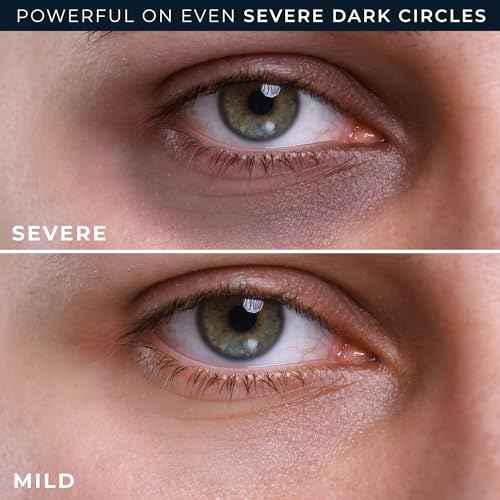 RoC Derm Correxion Retinol Eye Repair Dark Circle Cream Treatment with Niacinamide, Resveratrol, Proxygen for puffy eyes, wrinkles, and crow's feet with Line Smoothing Eye Packette