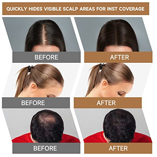 Mifeloy 2 Pack Root Cover Up Powder, Medium Brown - Long-lasting Gray Hair Root Concealer for Hairline, Beard Line, Eyebrow, Instantly Covers Thinning Grays, Touch Up Hair Color for Travel