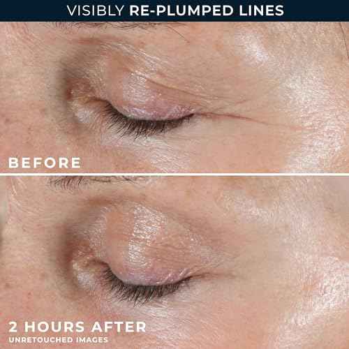 RoC Retinol Correxion Deep Wrinkle Non-Invasive Targeted Patches with Hyaluronic Acid + Firming Peptides for Forehead, 11 Lines, Crow¡¯s Feet and Laugh Lines, (6 Patches) with Retinol Eye Packette