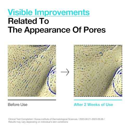 ANUA BHA 2% Gentle Exfoliating Toner, Mild Facial Exfoliant, Salicylic Acid for Pores and Sebum, Teatree Extract, Hyaluronic Acid, Ceramides (150ml / 5.07 fl.oz.)