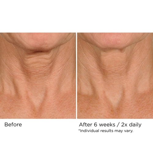 NassifMD Neck & Decollete Firming Complex - Lifting Treatment for Youthful Skin